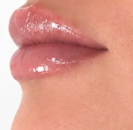 Lippen na een lipbooster